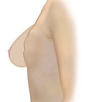 Designed to Fit Your Contours Designed to Fit Your Contours